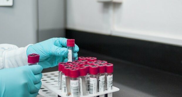 Lab Samples