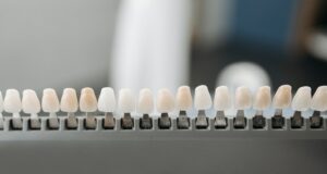 Veneers