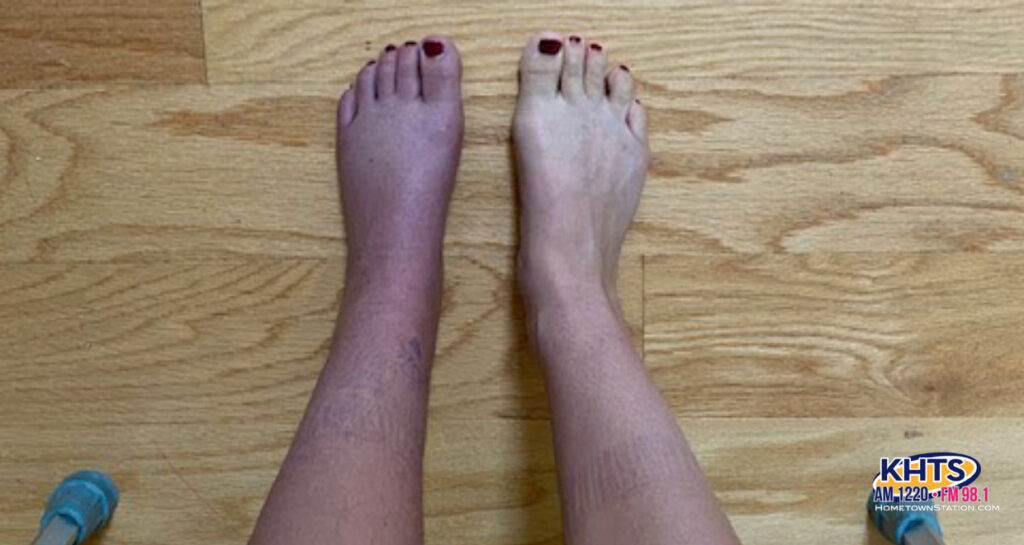 8/14/23 CRPS